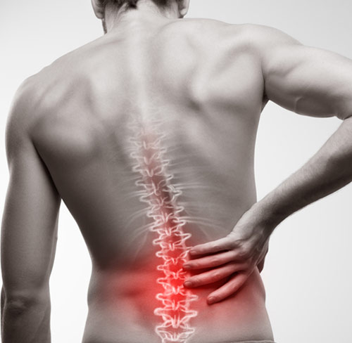 Incorrect Back Posture And Back Pain
