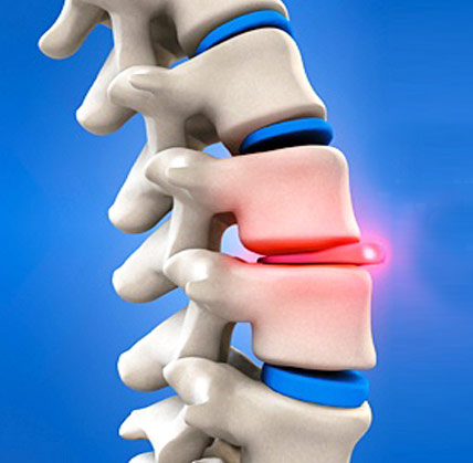 Getting Lumbar Spinal Stenosis Treatment From Best Spine Surgeon In Gurgaon