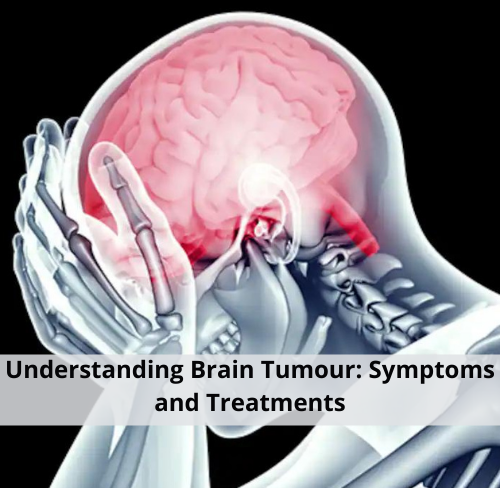 Understanding Brain Tumor: Symptoms and Treatments