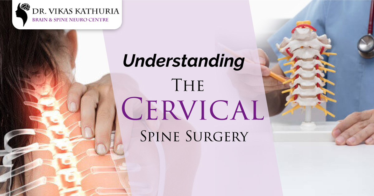 Understanding the Cervical Spine Surgery