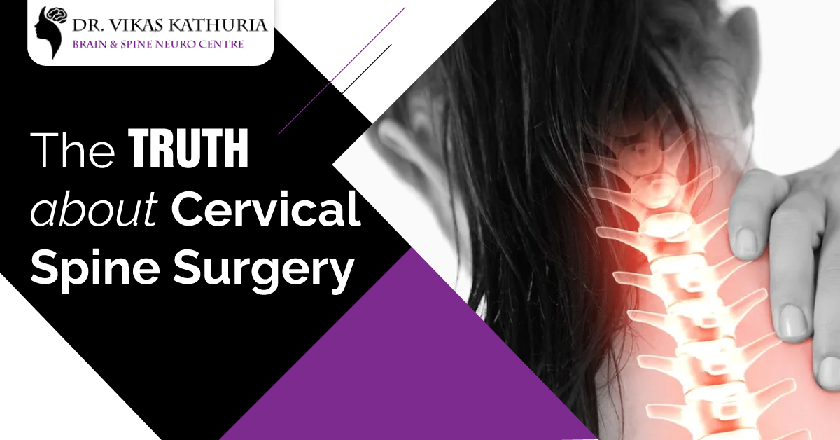 The Truth About Cervical Spine Surgery