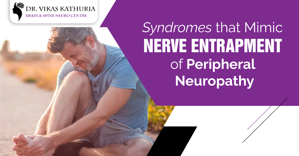 Syndromes that Mimic Nerve Entrapment of Peripheral Neuropathy