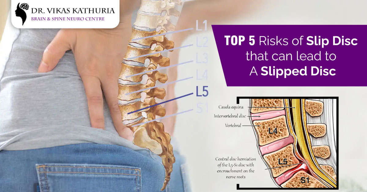 Top 5 Risks That Can Lead To A Slipped Disc