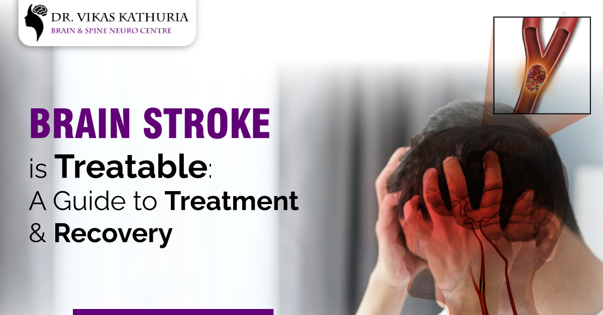 Brain Stroke is Treatable: A Guide To Treatment & Recovery