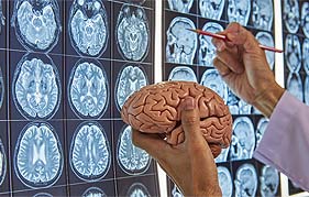 Best Neurosurgeon in Gurgaon