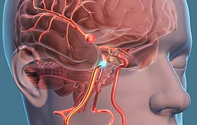 Best Neurosurgeon in Gurgaon