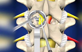Best Neurosurgeon in Gurgaon