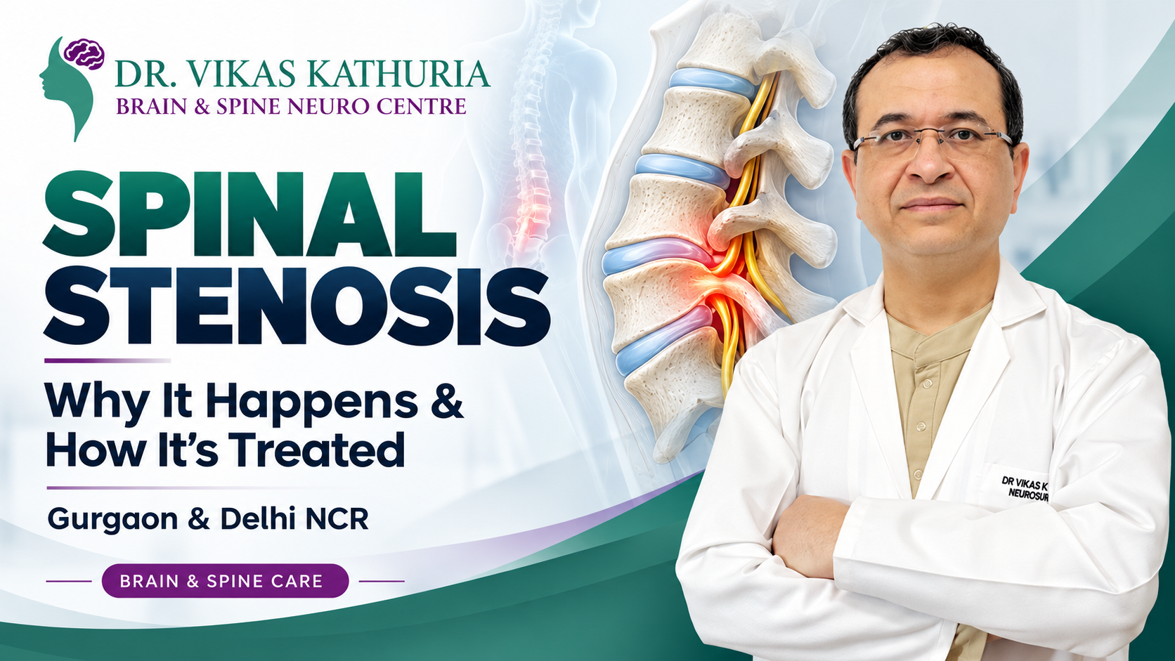 Spinal Stenosis: Why It Happens and How It’s Treated in Gurgaon & Delhi NCR